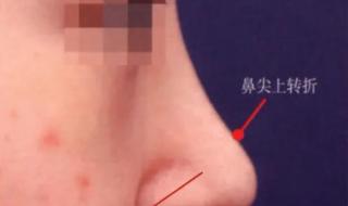 鼻头鼻翼缩小手术多少钱 鼻头缩小要花多少钱